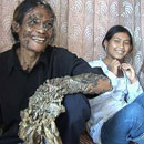 Root man